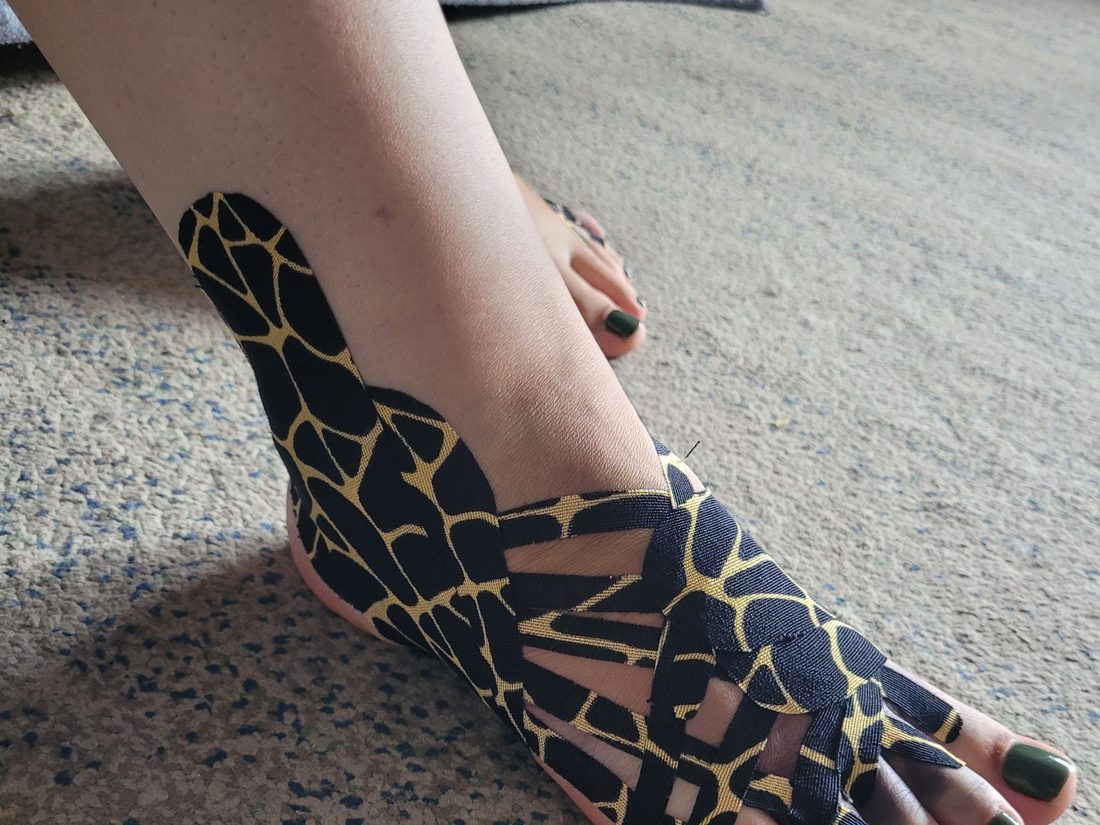Kinesiotaping stopy — aplikacja taśm korygujących